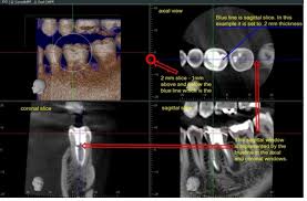 dental ti blog dental imaging