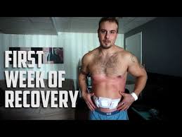hernia surgery recovery first week