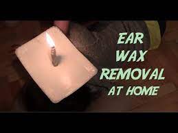 How To Removing Ear Wax With Candles
