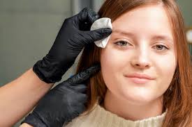 laser eyebrow tattoo removal our