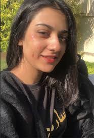 sarah khan shared her injured face