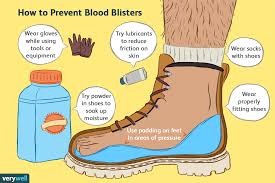 causes and treatments for blood blisters