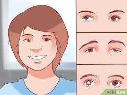 Lazy eye (amblyopia) is a condition in which one eye has poor vision due to a lack of coordination between the brain and eye. How To Get Rid Of A Lazy Eye With Pictures Wikihow