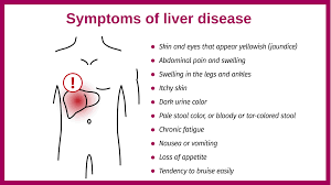 symptoms of liver disease british