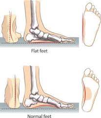 how to pick shoes for flat feet