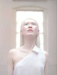 3 women with albinism share their