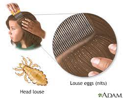 head lice medlineplus medical encyclopedia