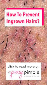 Ingrown hairs are actually skin wounds. Ever Dread Shaving Worried About Getting Those Red Itchy Bumps Ingrown Hairs Develop When Hairs Curl U Ingrown Hair Ingrown Hair Bump Ingrown Hair Bikini