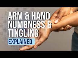 arm and hand numbness and tingling