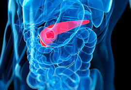 Pancreatic cancer is an aggressive form of cancer for which treatment options are limited. Pancreatic Cancer Cells Recruit Nerves To Supply Nutrient
