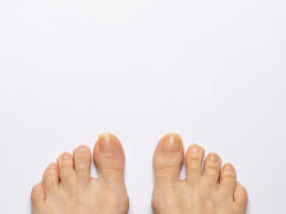 8 causes of yellow toenails plus