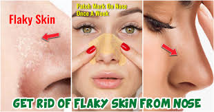 treat flaky skin on your nose