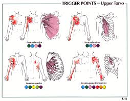 Trigger Point Referral Patterns Balance In Motion Bodywork