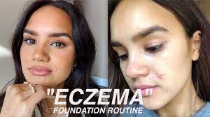foundation routine for eczema