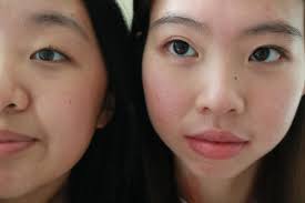 asian beauty standards causing more