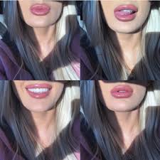 lip injections in gilbert az colair