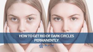 get rid of dark circles permanently
