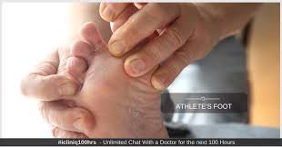 what is an athlete s foot
