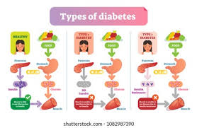 1 970 type 1 diabetes images stock