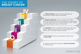 Stages Of Breast Cancer Memorial Sloan Kettering Cancer Center