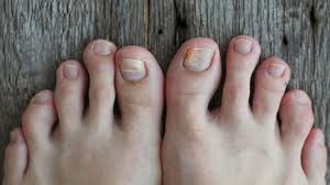 10 common foot problems and how to