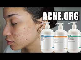skincare routine acne org