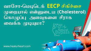 Check spelling or type a new query. What Is Eecp Treatment Ecp Therapy Non Invasive Cardiac Care Healurheart