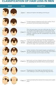 We did not find results for: Types Of Hair Loss For Men In New York Feller And Bloxham Medical