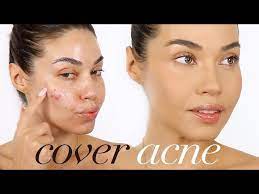 how to cover acne with makeup eman