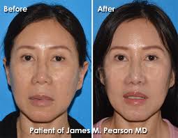 dr james pearson plastic surgery