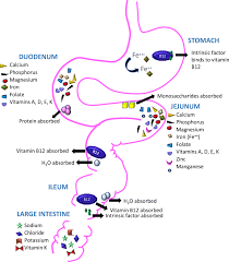 duodenal switch