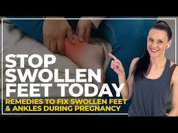 swollen feet pregnancy fix stop