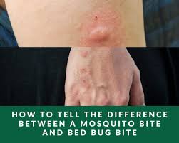mosquito bite and bed bug bite