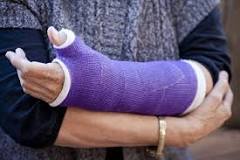 Image result for icd 10 code for nondisplaced right ulnar styloid fracture