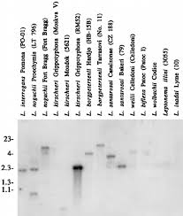 Southern Blot Analysis Of Eco Ri Restricted Genomic Dna From