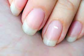 white spots on fingernails here s what