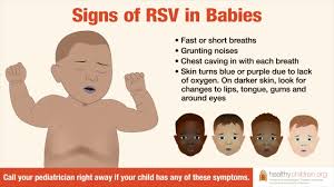 signs symptoms of rsv in es aap