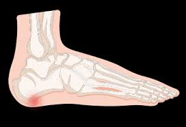 Identifying Your Foot Pain 2019 Treadmillreviews Net
