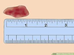 How To Measure Wounds 14 Steps With Pictures Wikihow