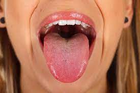 tongue cancer causes types symptoms