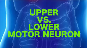 upper vs lower motor neuron lesions