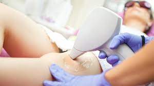 will laser hair removal get rid of