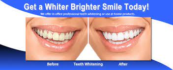 who can perform teeth whitening