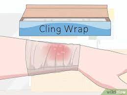 Like my grand aunt always say prevention is better than cure. 3 Ways To Treat A Second Degree Burn Wikihow