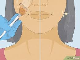 get rid of lines around your mouth