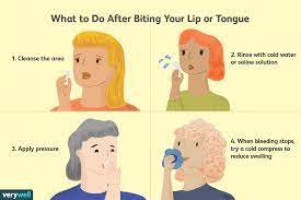 what to do when you bite your lip or tongue