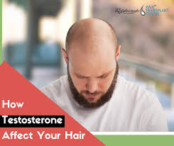 how testosterone affect your hair and