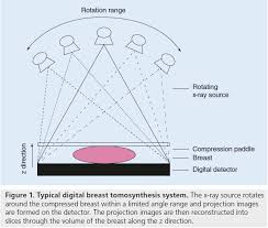 Digital Breast Tomosynthesis A Concise Overview
