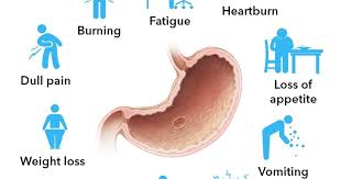 what are the symptoms of stomach ulcer