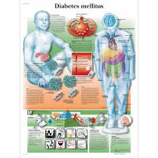 Diabetes Mellitus Chart